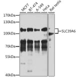 Western Blot - Anti-SLC39A6/ZIP-6 Antibody (A11772) - Antibodies.com