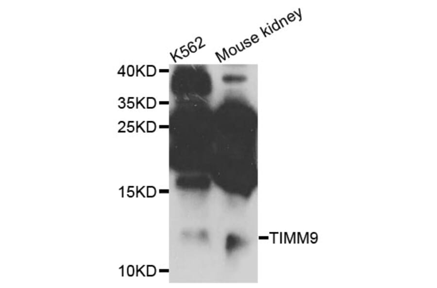 Western Blot - Anti-TIMM9 Antibody (A4627) - Antibodies.com