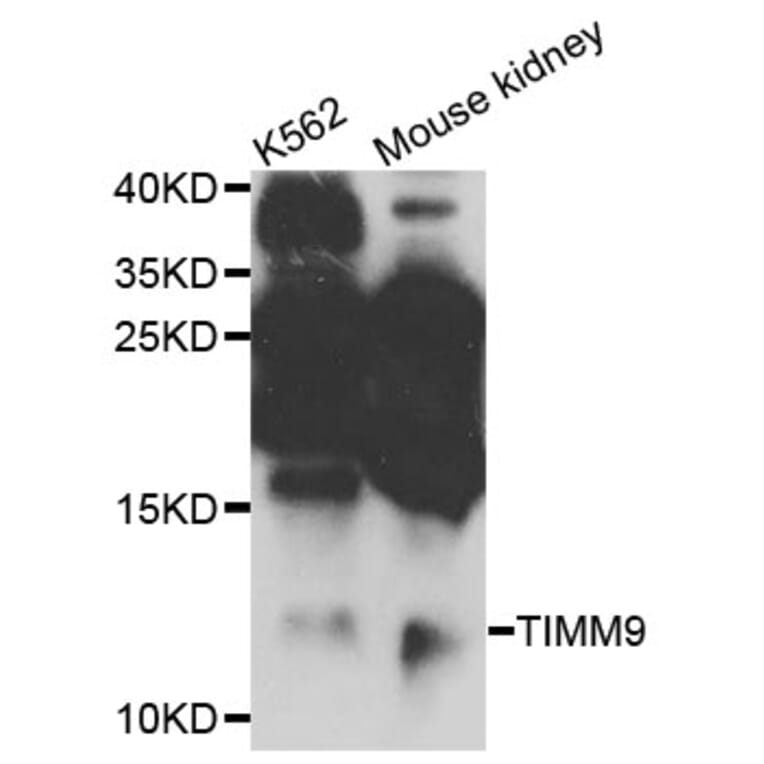 Western Blot - Anti-TIMM9 Antibody (A4627) - Antibodies.com