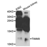 Western Blot - Anti-TIMM9 Antibody (A4627) - Antibodies.com