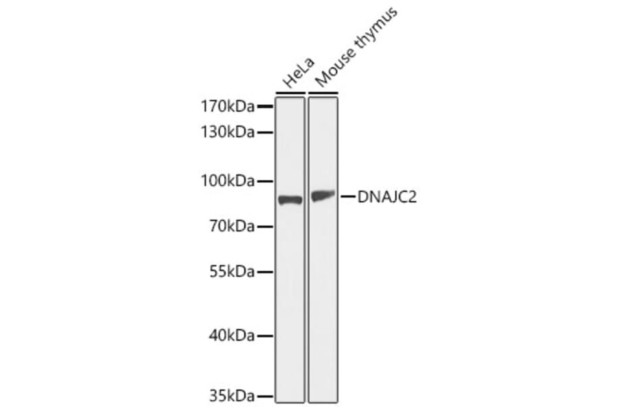 Western Blot - Anti-DNAJC2 Antibody (A11774) - Antibodies.com