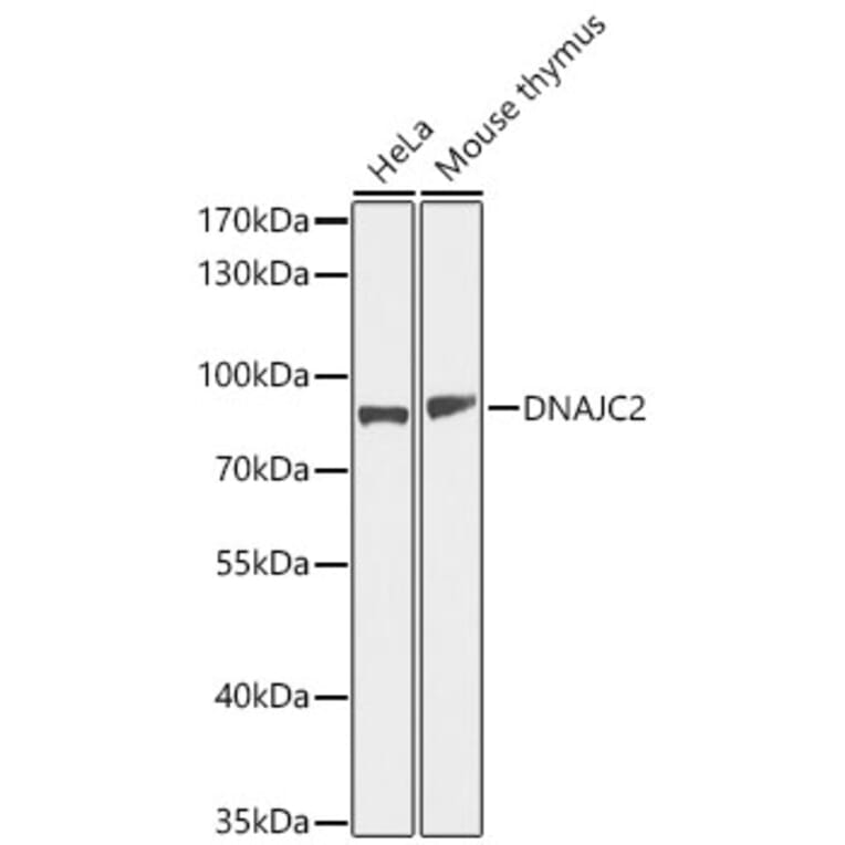 Western Blot - Anti-DNAJC2 Antibody (A11774) - Antibodies.com