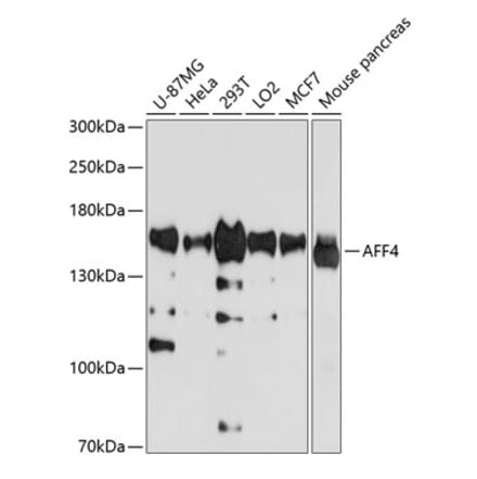 Western Blot - Anti-AFF4 Antibody (A11775) - Antibodies.com