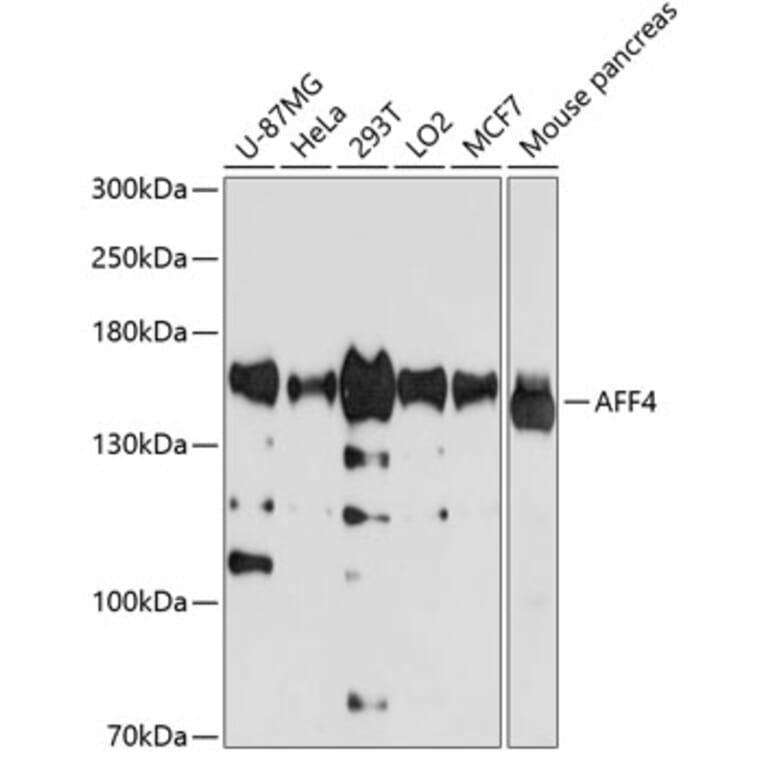 Western Blot - Anti-AFF4 Antibody (A11775) - Antibodies.com