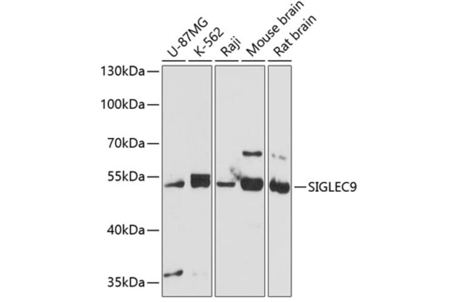 Western Blot - Anti-SIGLEC9 Antibody (A11776) - Antibodies.com