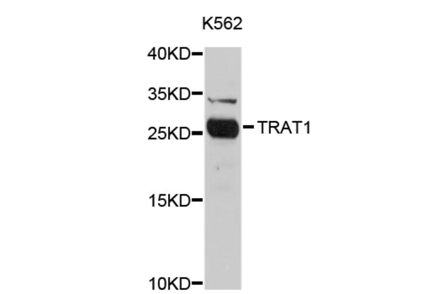 Western Blot - Anti-TRAT1 Antibody (A4696) - Antibodies.com