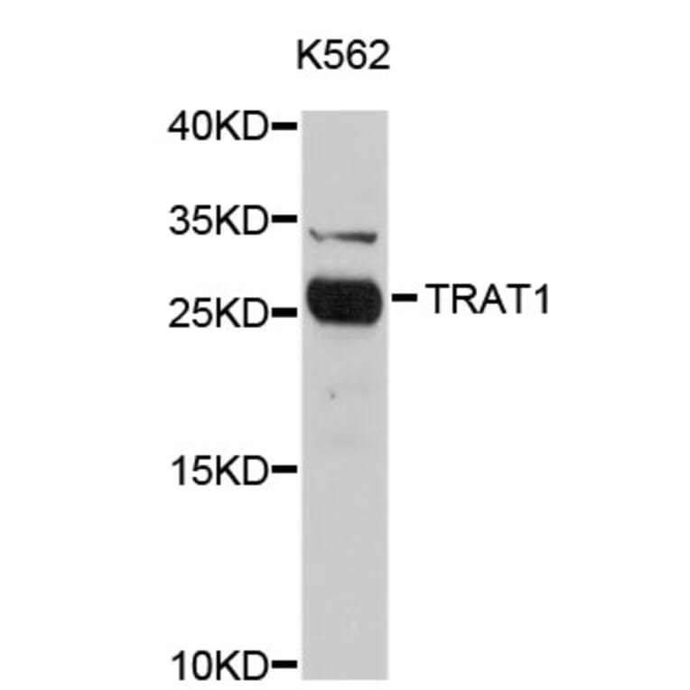 Western Blot - Anti-TRAT1 Antibody (A4696) - Antibodies.com