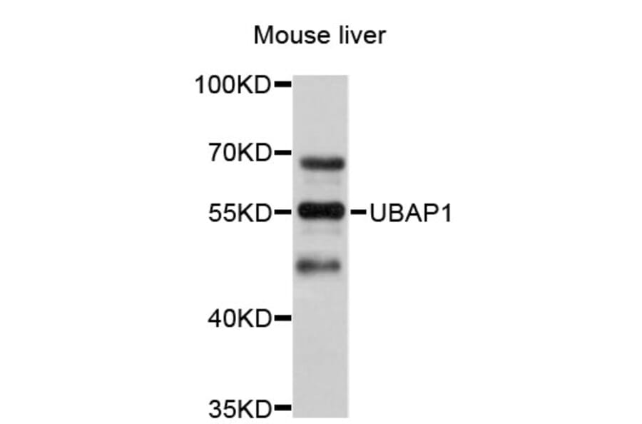 Western Blot - Anti-UBAP1 Antibody (A4726) - Antibodies.com