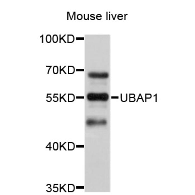 Western Blot - Anti-UBAP1 Antibody (A4726) - Antibodies.com