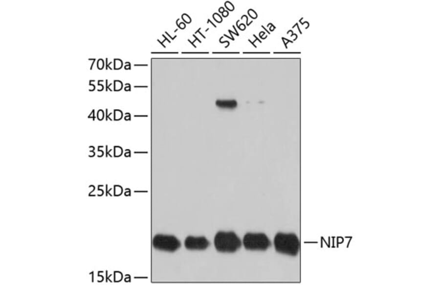Western Blot - Anti-NIP7 Antibody (A11781) - Antibodies.com