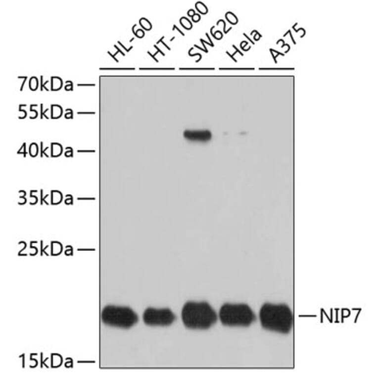 Western Blot - Anti-NIP7 Antibody (A11781) - Antibodies.com