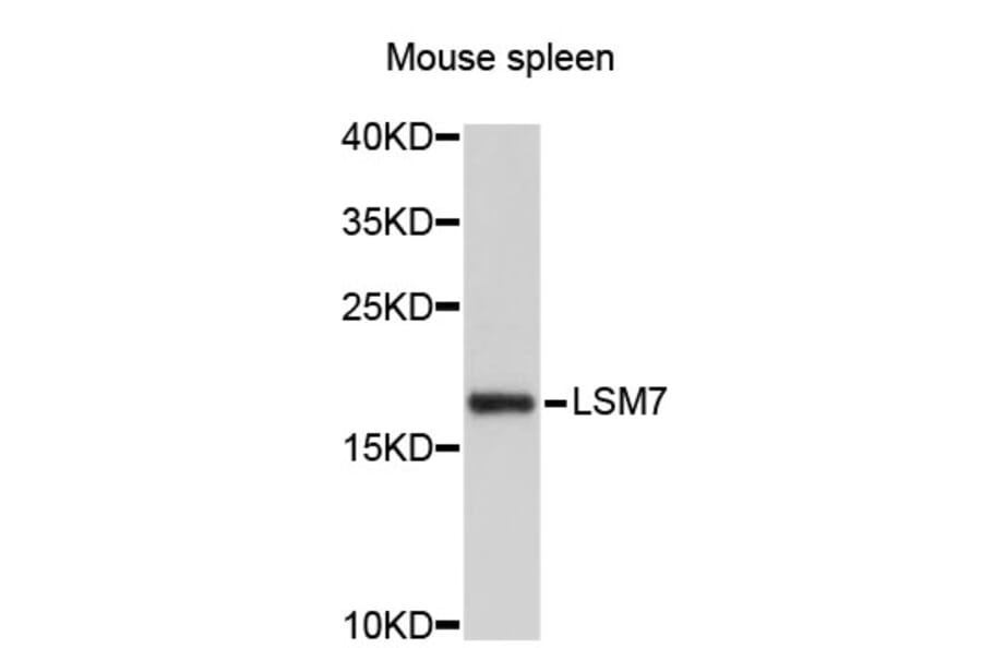 Western Blot - Anti-LSM7 Antibody (A4757) - Antibodies.com