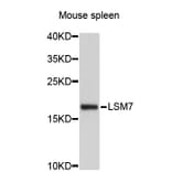 Western Blot - Anti-LSM7 Antibody (A4757) - Antibodies.com