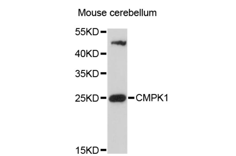 Western Blot - Anti-CMPK1 Antibody (A4761) - Antibodies.com