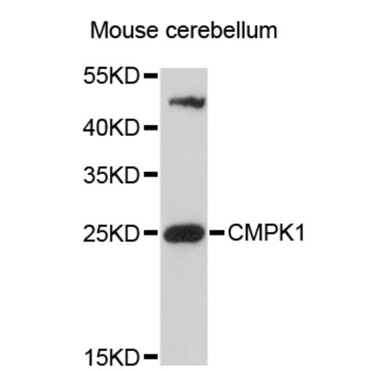 Western Blot - Anti-CMPK1 Antibody (A4761) - Antibodies.com