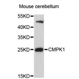 Western Blot - Anti-CMPK1 Antibody (A4761) - Antibodies.com