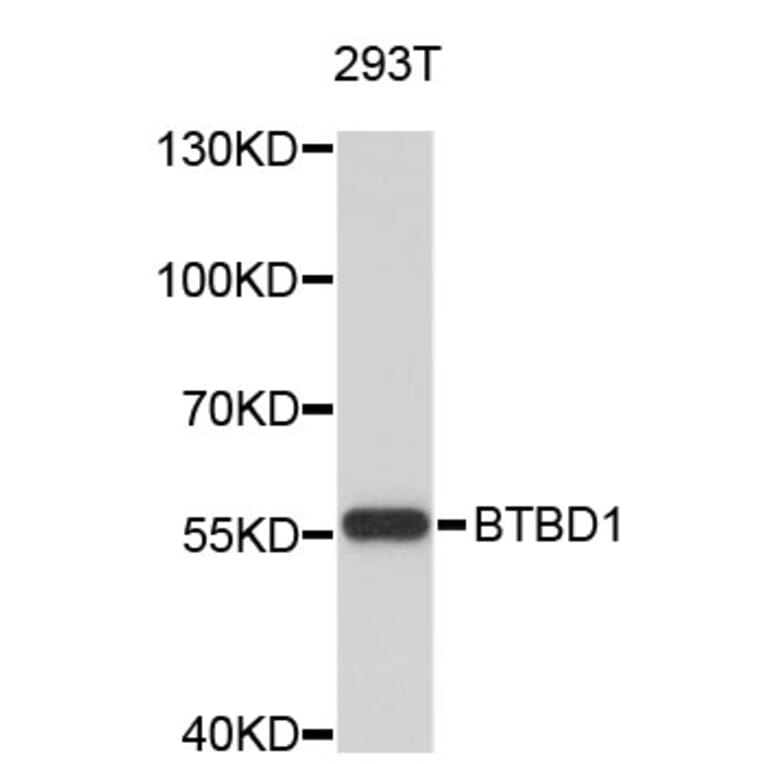 Western Blot - Anti-BTBD1 Antibody (A4768) - Antibodies.com