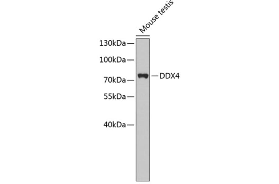 Western Blot - Anti-DDX4 Antibody (A4787) - Antibodies.com