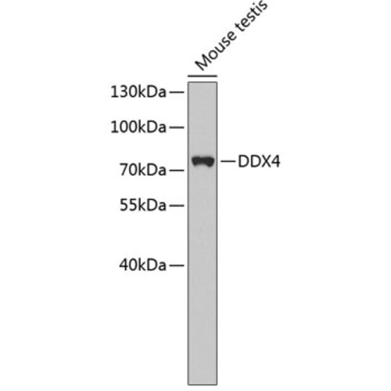Western Blot - Anti-DDX4 Antibody (A4787) - Antibodies.com
