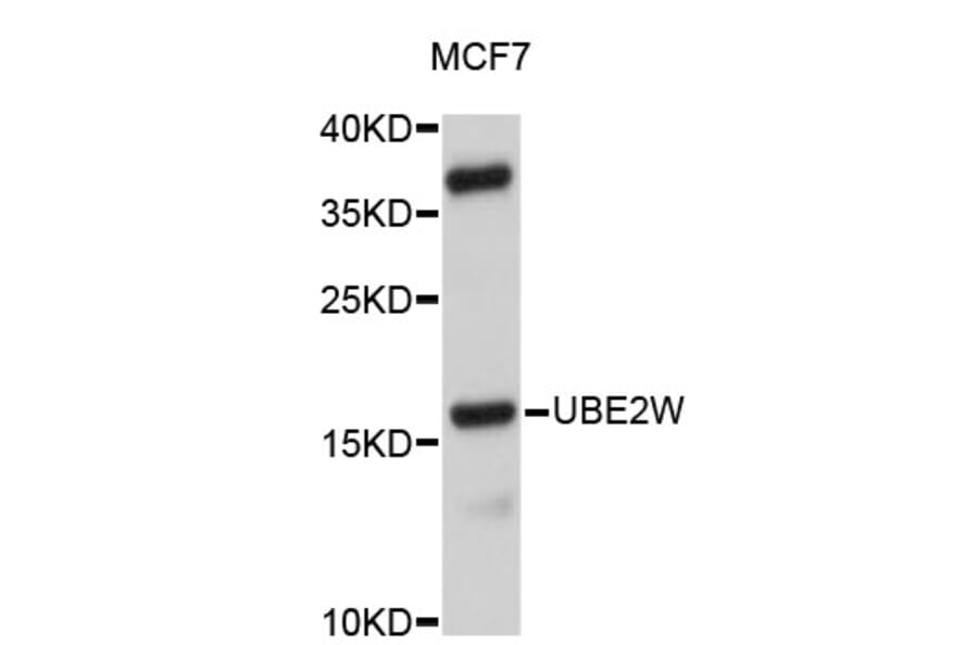 Western Blot - Anti-UBE2W Antibody (A4822) - Antibodies.com