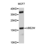 Western Blot - Anti-UBE2W Antibody (A4822) - Antibodies.com