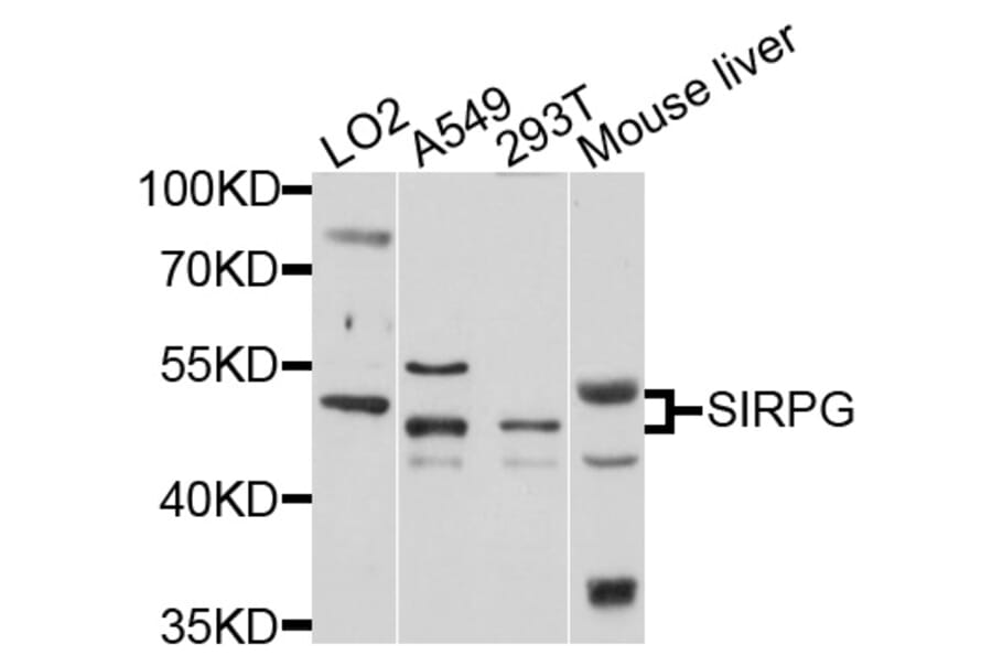Western Blot - Anti-SIRPG Antibody (A4832) - Antibodies.com