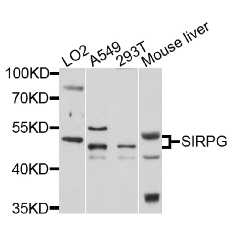 Western Blot - Anti-SIRPG Antibody (A4832) - Antibodies.com