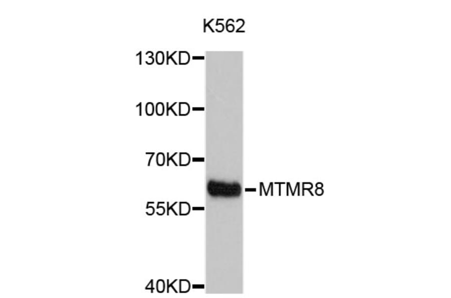 Western Blot - Anti-MTMR8 Antibody (A4834) - Antibodies.com
