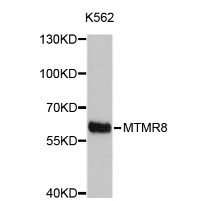Western Blot - Anti-MTMR8 Antibody (A4834) - Antibodies.com