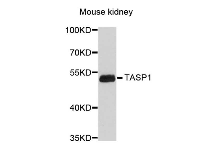 Western Blot - Anti-TASP1 Antibody (A4836) - Antibodies.com