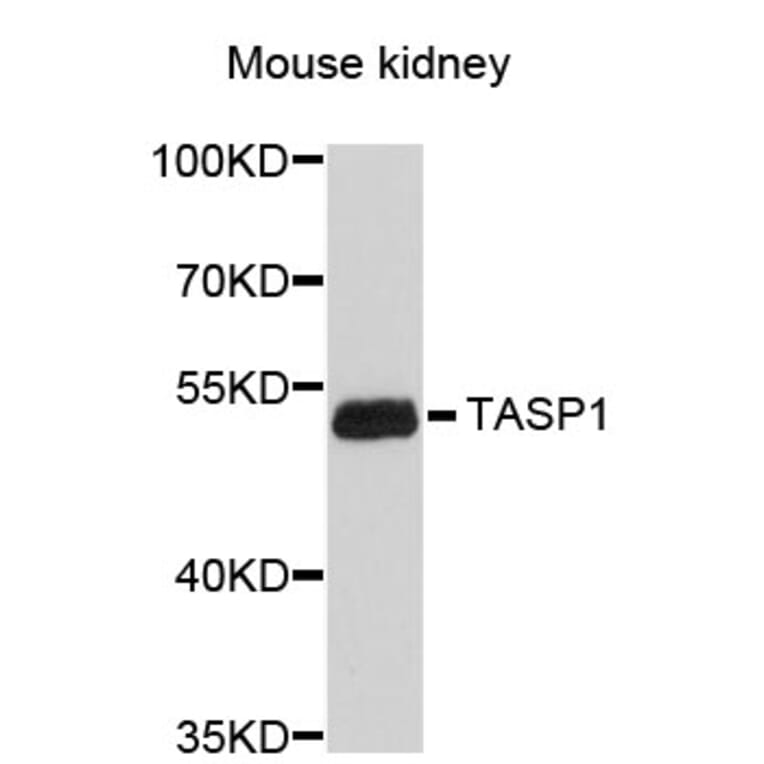 Western Blot - Anti-TASP1 Antibody (A4836) - Antibodies.com