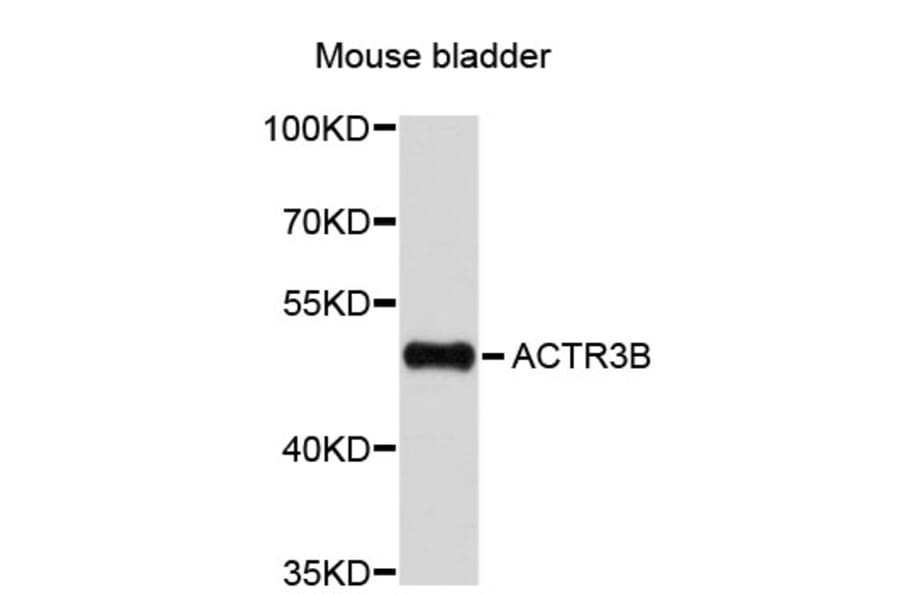 Western Blot - Anti-ACTR3B Antibody (A4889) - Antibodies.com