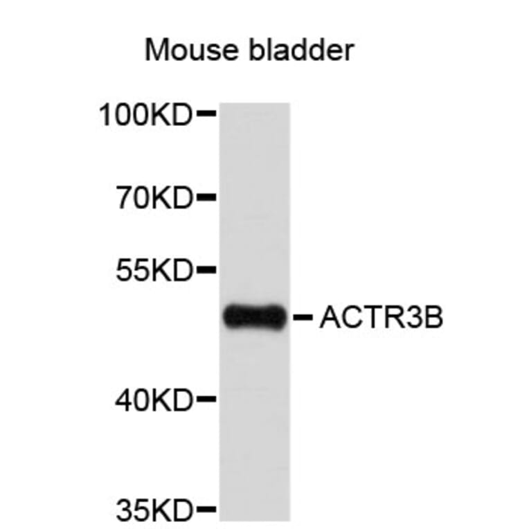 Western Blot - Anti-ACTR3B Antibody (A4889) - Antibodies.com