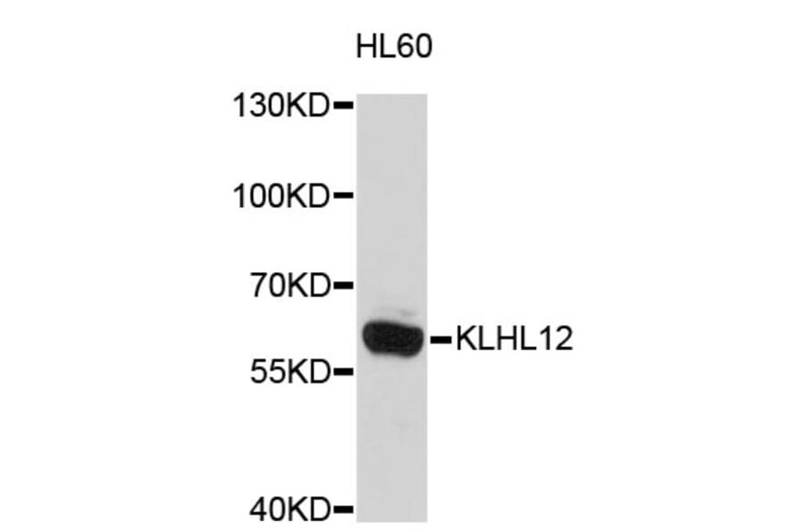 Western Blot - Anti-KLHL12 Antibody (A4906) - Antibodies.com