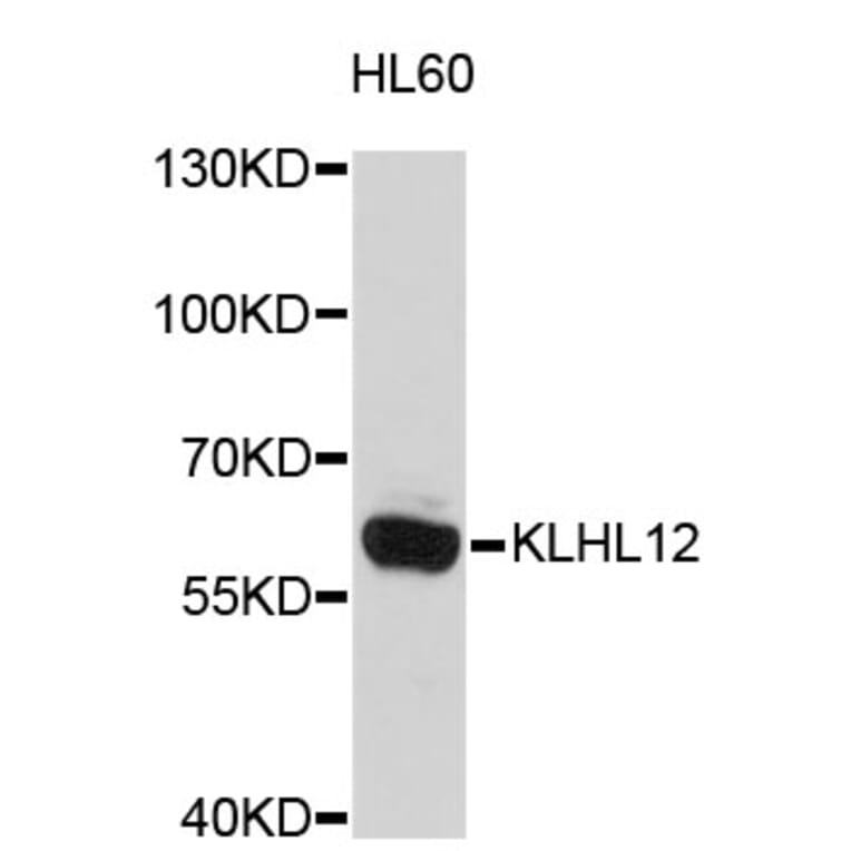 Western Blot - Anti-KLHL12 Antibody (A4906) - Antibodies.com