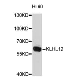 Western Blot - Anti-KLHL12 Antibody (A4906) - Antibodies.com
