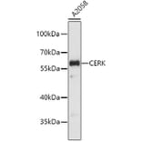 Western Blot - Anti-CERK Antibody (A4935) - Antibodies.com