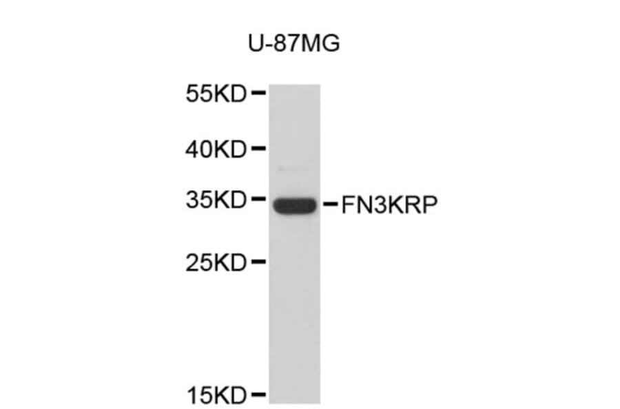 Western Blot - Anti-FN3KRP Antibody (A4977) - Antibodies.com