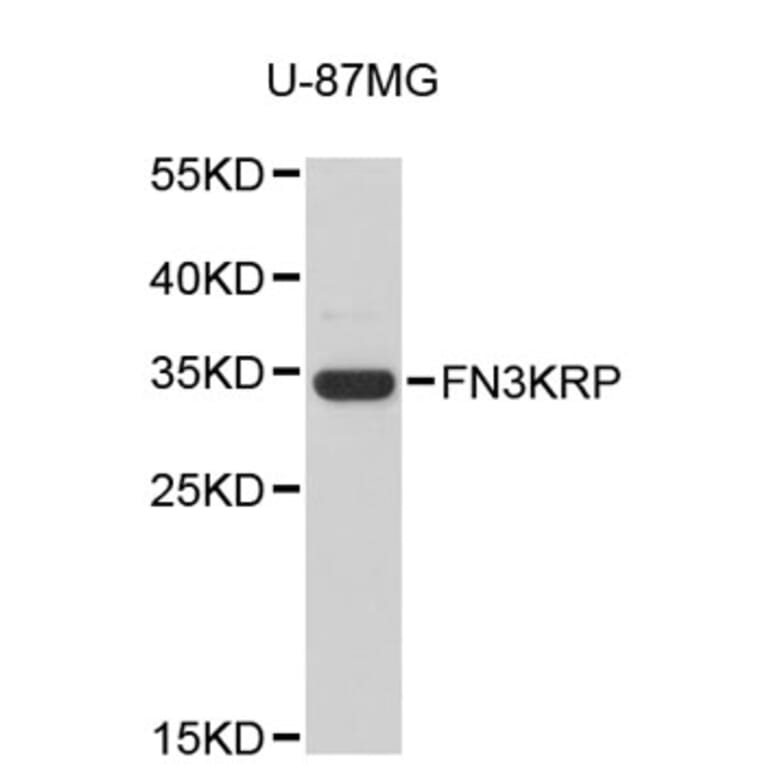 Western Blot - Anti-FN3KRP Antibody (A4977) - Antibodies.com
