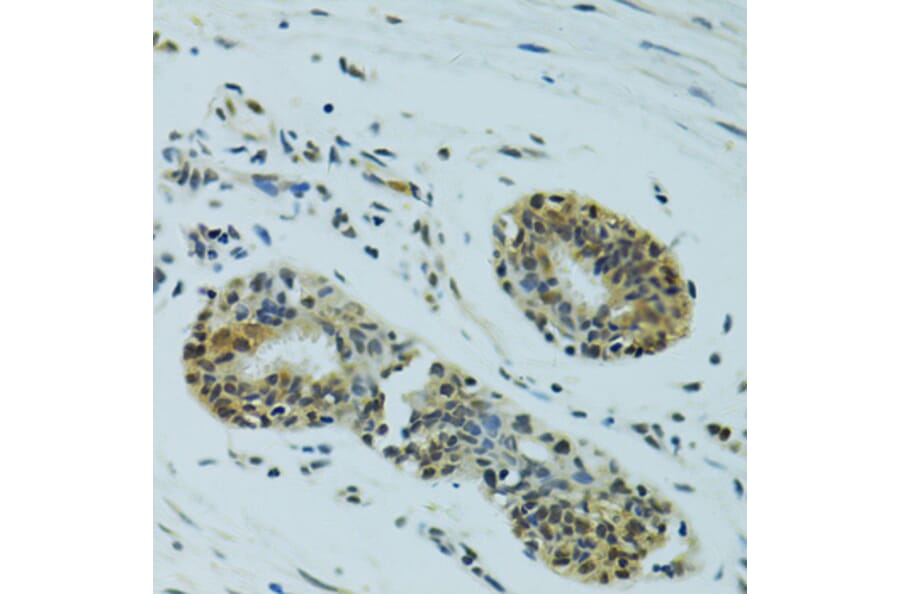 Immunohistochemistry - Anti-NHEJ1 Antibody (A4985) - Antibodies.com