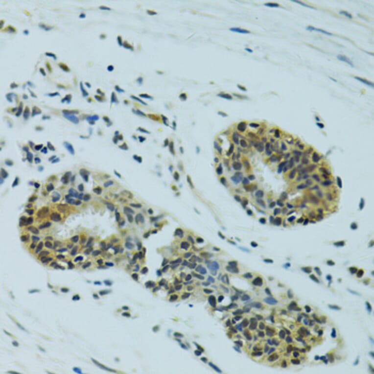 Immunohistochemistry - Anti-NHEJ1 Antibody (A4985) - Antibodies.com