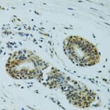 Immunohistochemistry - Anti-NHEJ1 Antibody (A4985) - Antibodies.com