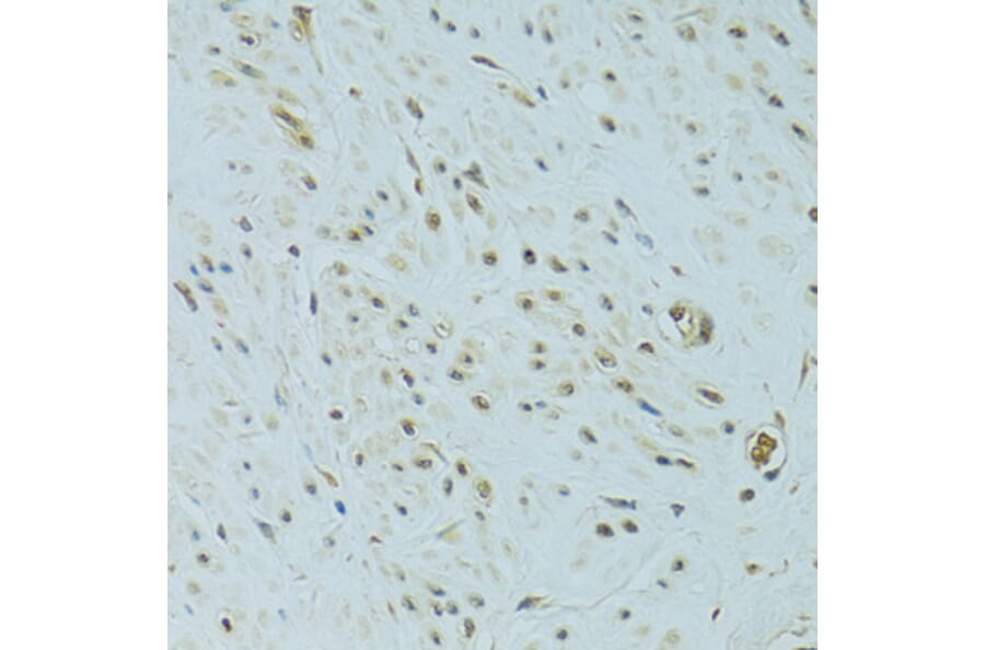 Immunohistochemistry - Anti-NHEJ1 Antibody (A4985) - Antibodies.com