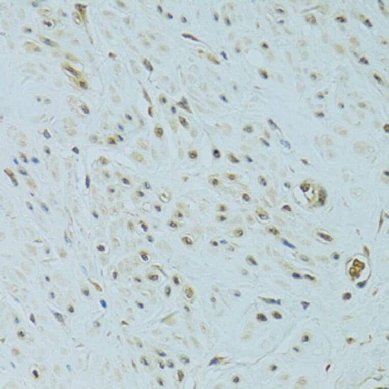 Immunohistochemistry - Anti-NHEJ1 Antibody (A4985) - Antibodies.com