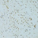 Immunohistochemistry - Anti-NHEJ1 Antibody (A4985) - Antibodies.com