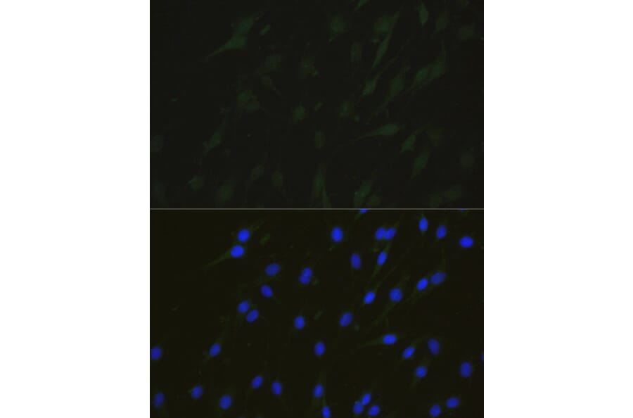 Immunofluorescence - Anti-NHEJ1 Antibody (A4985) - Antibodies.com