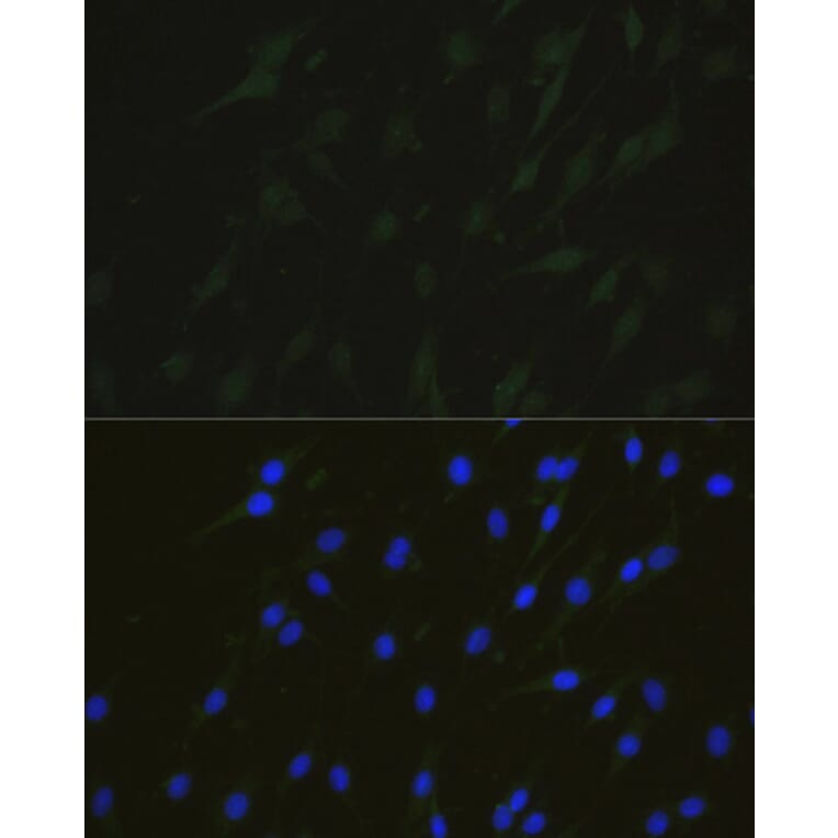 Immunofluorescence - Anti-NHEJ1 Antibody (A4985) - Antibodies.com