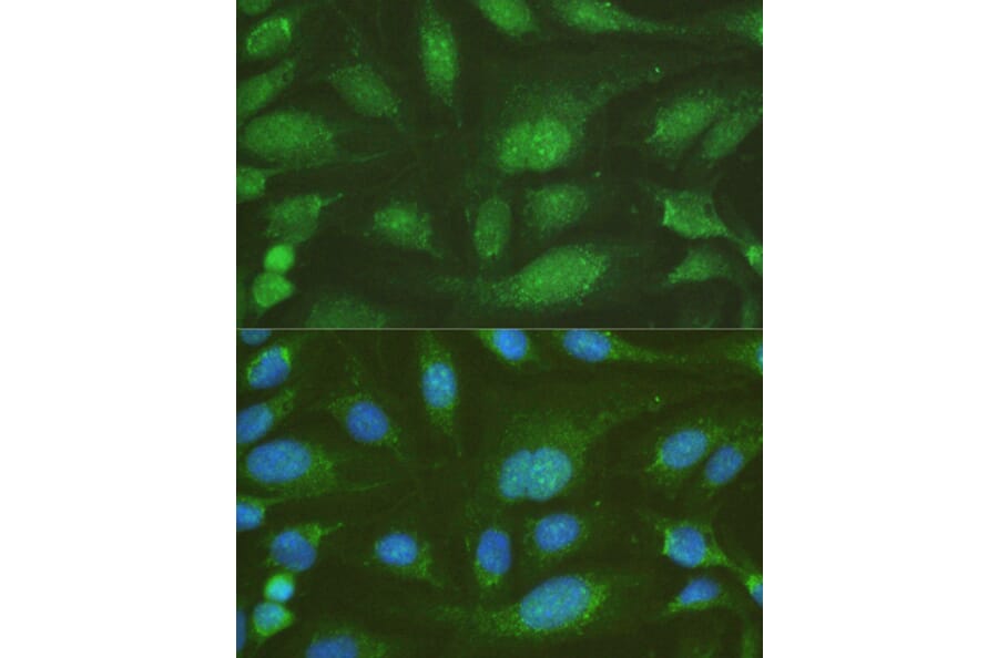 Immunofluorescence - Anti-NHEJ1 Antibody (A4985) - Antibodies.com