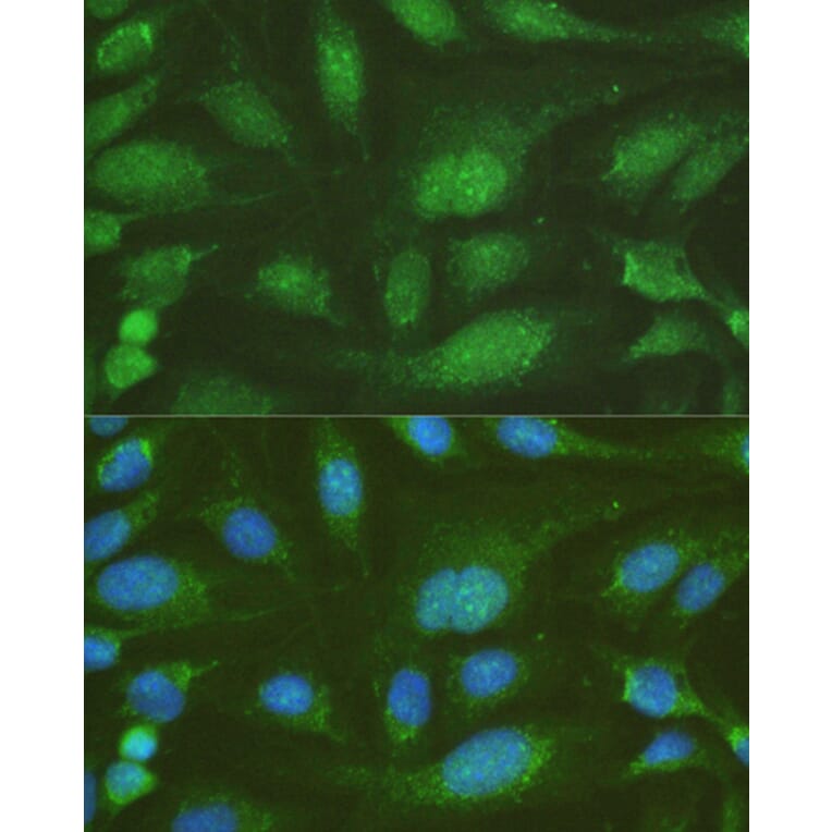 Immunofluorescence - Anti-NHEJ1 Antibody (A4985) - Antibodies.com