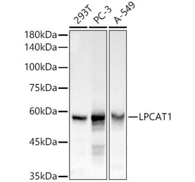 Western Blot - Anti-LPCAT1 Antibody (A11800) - Antibodies.com